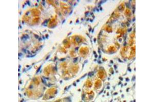 Used in DAB staining on fromalin fixed paraffin-embedded Stomach tissue (Frataxin Antikörper  (AA 57-198))