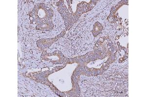 IHC analysis of CLASP1 using anti-CLASP1 antibody (ABIN7599144). (CLASP1 Antikörper  (AA 1-243))