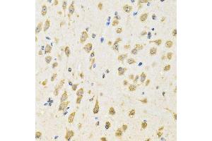 Immunohistochemistry (Paraffin-embedded Sections) (IHC (p)) image for anti-Protein tyrosine Phosphatase, Receptor Type, E (PTPRE) (AA 20-200) antibody (ABIN6146460)
