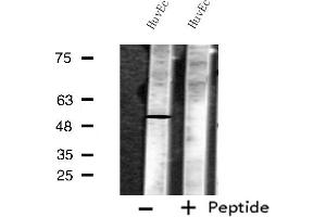 Western blot analysis of extracts from HuvEc cells, using MKNK1 antibody. (MKNK1 Antikörper  (Internal Region))