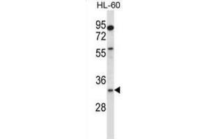 Western Blotting (WB) image for anti-Egl-9 Family Hypoxia Inducible Factor 3 (EGLN3) antibody (ABIN2997822) (EGLN3 Antikörper)