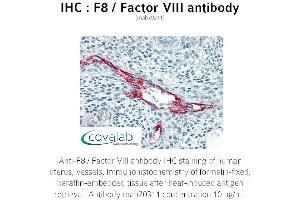 Image no. 1 for anti-Coagulation Factor VIII (F8) antibody (ABIN1723234) (Factor VIII Antikörper)