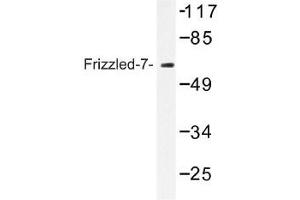 Image no. 1 for anti-Frizzled Family Receptor 7 (FZD7) antibody (ABIN317734) (FZD7 Antikörper)