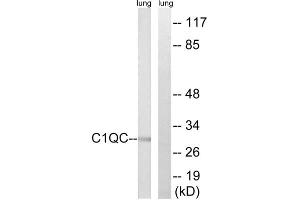 Western blot analysis of extracts from rat lung cells, using C1QC antibody. (C1QC Antikörper  (Internal Region))