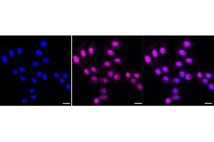 Immunocytochemical staining of HepG2 cells with PGC1 beta antibody (ABIN7799784), 1:1,000).