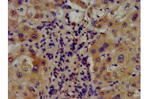 IHC image of ABIN7144688 diluted at 1:400 and staining in paraffin-embedded human liver tissue performed on a Leica BondTM system. (Arylsulfatase E Antikörper  (AA 352-494))