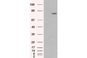 HEK293 overexpressing Human CTNNA1 (RC201766) and probed with ABIN185626 (mock transfection in first lane), tested by Origene.