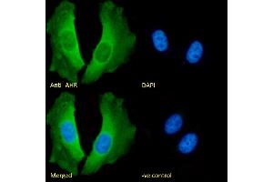 (ABIN5539467) Immunofluorescence analysis of paraformaldehyde fixed HeLa cells, permeabilized with 0. (Aryl Hydrocarbon Receptor Antikörper  (Internal Region))