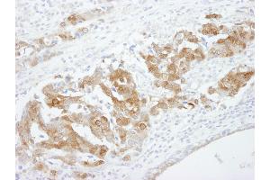 Immunohistochemistry (IHC) image for anti-Cellular Retinoic Acid Binding Protein 2 (CRABP2) (C-Term) antibody (ABIN7448487) (CRABP2 Antikörper  (C-Term))