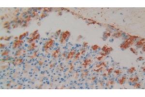 Detection of GP1BB in Rat Stomach Tissue using Polyclonal Antibody to Platelet Glycoprotein Ib Beta Chain (GP1BB) (GP1BB Antikörper  (AA 52-164))