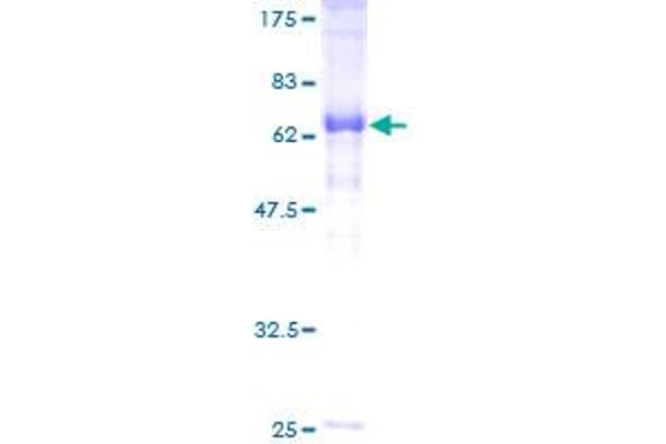 IVD Protein (AA 1-423) (GST tag)