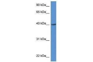 Western Blot showing Zdhhc11 antibody used at a concentration of 1. (ZDHHC11 Antikörper  (Middle Region))