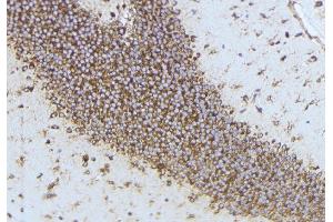 ABIN6277245 at 1/100 staining Mouse brain tissue by IHC-P.