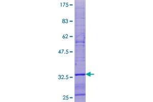 Image no. 1 for S-Phase Response (Cyclin Related) (SPHAR) (AA 1-63) protein (GST tag) (ABIN1321158) (SPHAR Protein (AA 1-63) (GST tag))