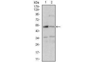 Western Blotting (WB) image for anti-Death-Associated Protein Kinase 3 (DAPK3) (AA 28-161) antibody (ABIN5542452)