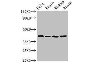Western Blot Positive WB detected in: Hela whole cell lysate, Rat brain tissue, Mouse kidney tissue, Mouse brain tissue All lanes: ATAD1 antibody at 4 μg/mL Secondary Goat polyclonal to rabbit IgG at 1/50000 dilution Predicted band size: 41, 33 kDa Observed band size: 41 kDa