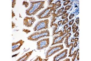 IHC analysis of EpCAM using anti-EpCAM antibody (ABIN7600081). (EpCAM Antikörper  (AA 147-189))