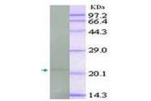 Image no. 1 for anti-Tumor Necrosis Factor alpha (TNF alpha) antibody (ABIN791557) (TNF alpha Antikörper)