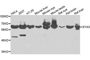 Western blot analysis of extracts of various cells, using EYA3 antibody. (EYA3 Antikörper)
