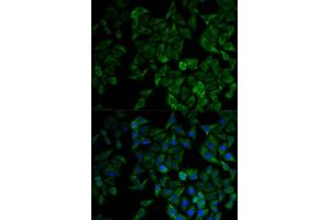 Immunofluorescence analysis of HeLa cell using TNFRSF1A antibody. (TNFRSF1A Antikörper)