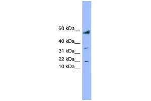 WB Suggested Anti-LYRM1 Antibody Titration: 0. (LYRM1 Antikörper  (Middle Region))