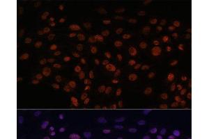 Immunofluorescence (IF) image for anti-Chromodomain Helicase DNA Binding Protein 4 (CHD4) antibody (ABIN7255670)