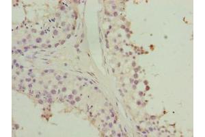 Immunohistochemistry of paraffin-embedded human testis tissue using ABIN7155901 at dilution of 1:100 (HORMAD2 Antikörper  (AA 14-307))