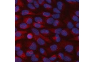 IF analysis of STBD1 using anti-STBD1 antibody (ABIN7601576). (STBD1 Antikörper  (AA 39-328))