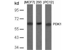 Image no. 4 for anti-3-phosphoinositide Dependent Protein Kinase-1 (PDPK1) (Ser241) antibody (ABIN197101) (PDPK1 Antikörper  (Ser241))