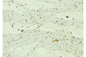 ABIN6277663 at 1/100 staining Mouse muscle tissue by IHC-P. (MAP1LC3A Antikörper  (Internal Region))
