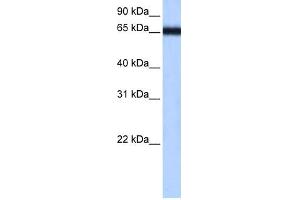 WB Suggested Anti-ZNF14 Antibody Titration:  0.