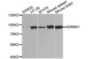 Western blot analysis of extracts of various cell lines, using ADRBK1 antibody. (GRK2 Antikörper  (AA 440-689))