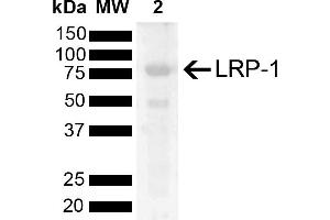 Western blot analysis of Rat Kidney showing detection of 504. (LRP1 Antikörper  (AA 2880-2980) (HRP))