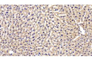 Detection of LEPR in Mouse Liver Tissue using Polyclonal Antibody to Leptin Receptor (LEPR) (Leptin Receptor Antikörper  (AA 22-203))