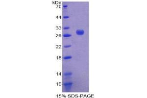 SDS-PAGE (SDS) image for POU domain, class 2, transcription factor 2 (POU2F2) (AA 236-459) protein (His tag) (ABIN2126190)