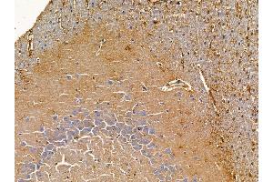 ABIN6265684 and ABIN6278747 at 1/100 staining rat brain tissue by IHC-P. (TPD52L1 Antikörper  (N-Term))