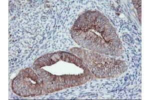 Image no. 1 for anti-Carboxypeptidase A2 (Pancreatic) (CPA2) antibody (ABIN1497596)