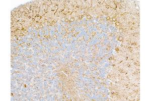 Immunohistochemistry (IHC) image for anti-Tubulin, beta 3 (TUBB3) (AA 400-450) antibody (ABIN7453957)