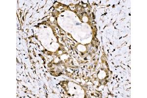 IHC analysis of KLF15 using anti-KLF15 antibody (ABIN7599269). (KLF15 Antikörper  (AA 1-323))