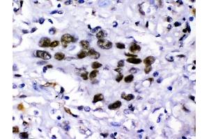 IHC analysis of KDM5B using anti-KDM5B antibody (ABIN4886648). (KDM5B Antikörper  (Middle Region))