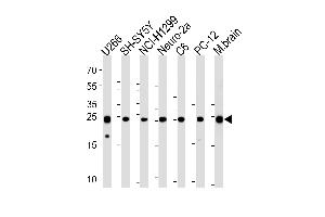 UCHL1 Antibody (C-term) (ABIN1882188 and ABIN2839165) western blot analysis in ,SH-SY5Y,NCI-,mouse Neuro-2a,rat C6,PC-12 cell line and mouse brain tissue lysates (35 μg/lane). (UCHL1 Antikörper  (C-Term))