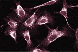 Immunofluorescence (IF) image for anti-RAB5A, Member RAS Oncogene Family (RAB5A) (AA 1-215) antibody (ABIN967882)