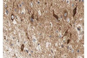 ABIN6267612 at 1/100 staining human brain tissue sections by IHC-P. (LIPE Antikörper  (pSer552))