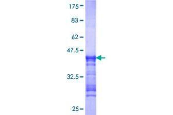 RIOK1 Protein (AA 1-100) (GST tag)