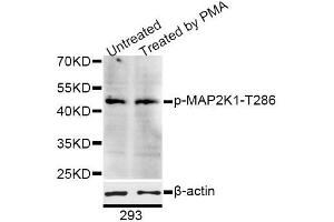 Western blot analysis of extracts of 293 cells, using Phospho-MAP2K1-T286 antibody (ABIN5995642) at 1/1000 dilution. (MEK1 Antikörper  (pThr285))