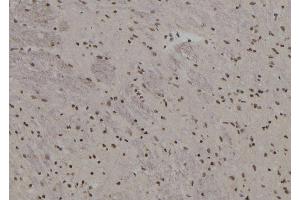 ABIN6273591 at 1/100 staining Rat brain tissue by IHC-P. (BACH2 Antikörper  (Internal Region))