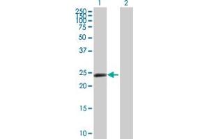 Western Blot analysis of ZNF501 expression in transfected 293T cell line by ZNF501 MaxPab polyclonal antibody. (ZNF501 Antikörper  (AA 1-262))