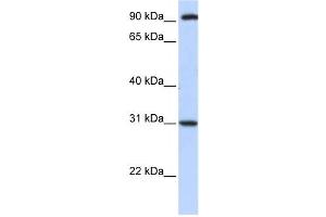 Western Blotting (WB) image for anti-Ankyrin Repeat, Family A (RFXANK-Like), 2 (ANKRA2) antibody (ABIN2459440) (ANKRA2 Antikörper)