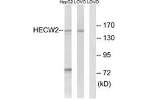 Western Blotting (WB) image for anti-HECT, C2 and WW Domain Containing E3 Ubiquitin Protein Ligase 2 (HECW2) (AA 481-530) antibody (ABIN2890283) (HECW2 Antikörper  (AA 481-530))