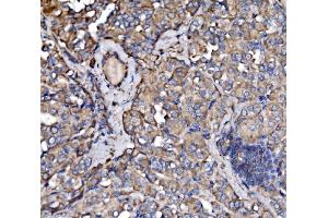 IHC analysis of PAK3 using anti-PAK3 antibody (ABIN7599182). (PAK3 Antikörper  (AA 1-263))